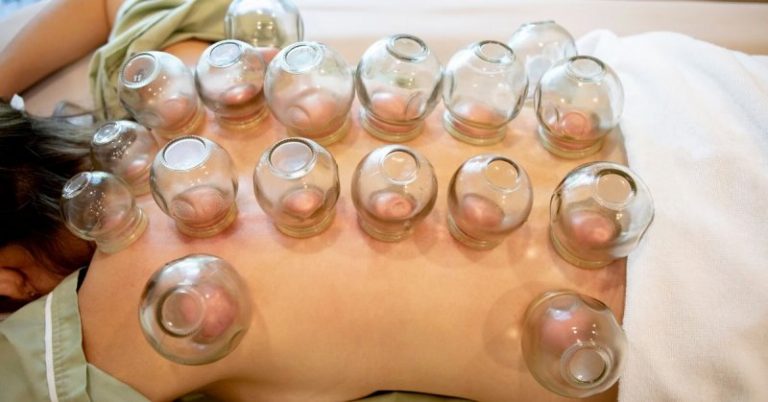 The Many Benefits Of Acupuncture