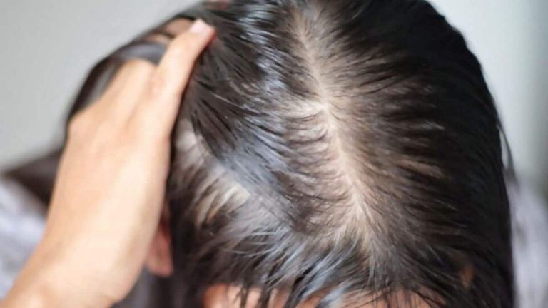 10 Best Conditioner for Oily Hair [ A Look Into the Future]