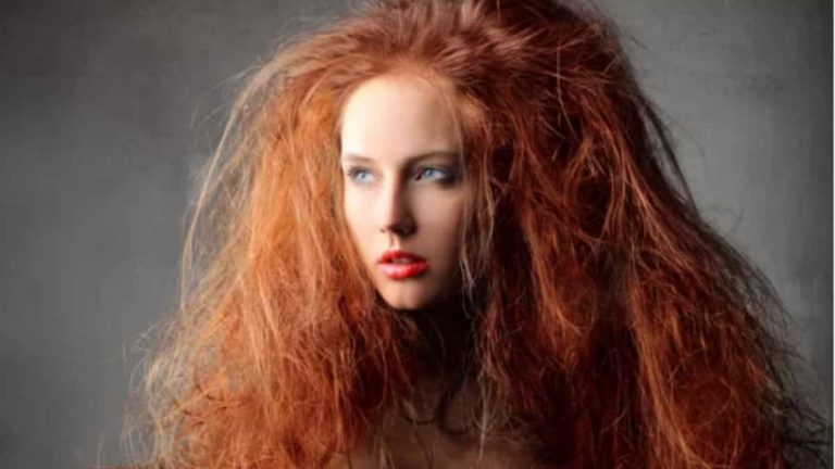 How To Treat Matted Hair [What I Wish I Knew]