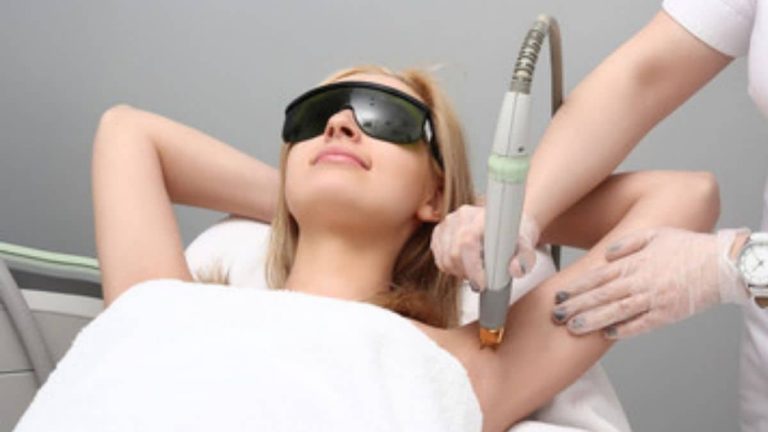 How old do you have to be for laser hair removal?