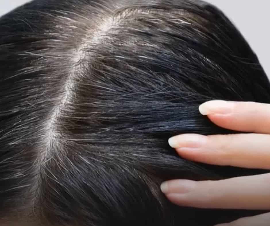 Is coconut oil and lemon juice good for grey hair