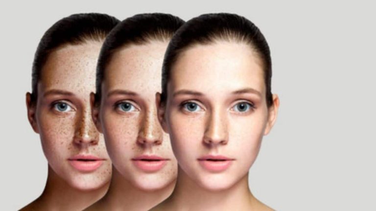 Korean skincare for dark spots [Do this routine every day for Better Skin]