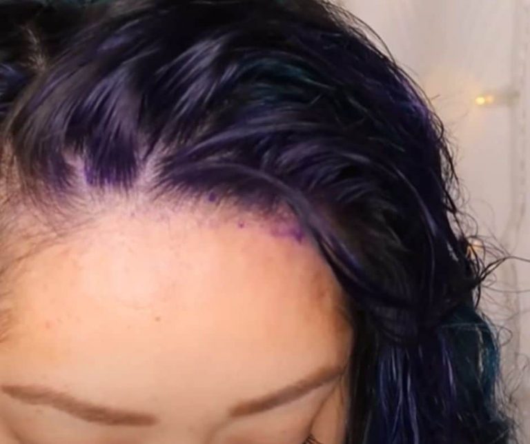 How to get hair dye off the scalp ReenaSidhu