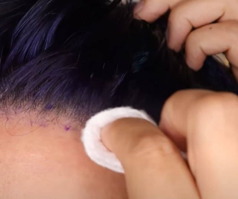 how-to-get-hair-dye-off-the-scalp-reenasidhu