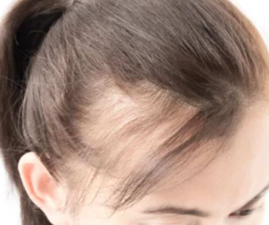How can I get thicker hair naturally 