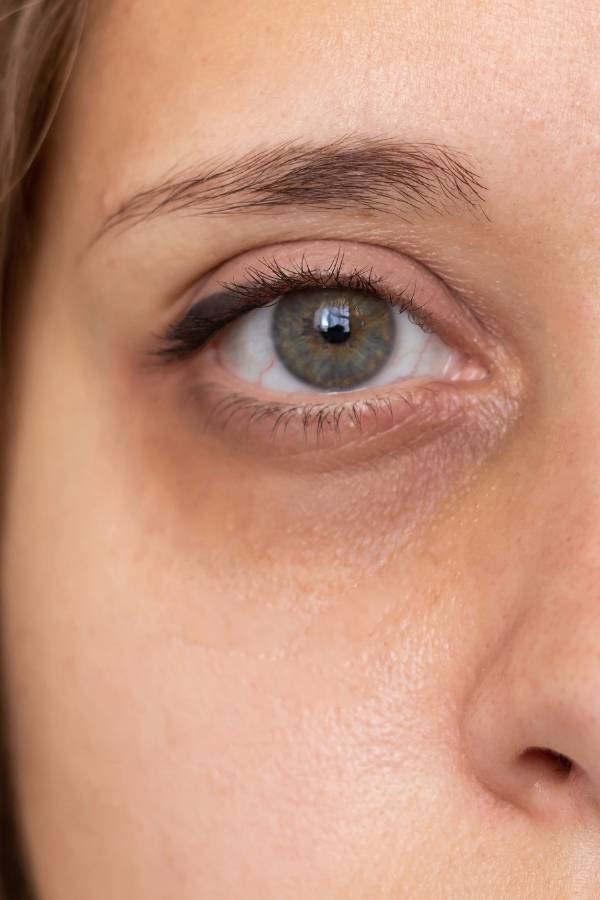 How to apply concealer on dark circles